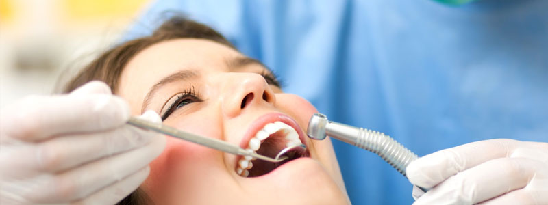 fresno vancouver dental cleaning